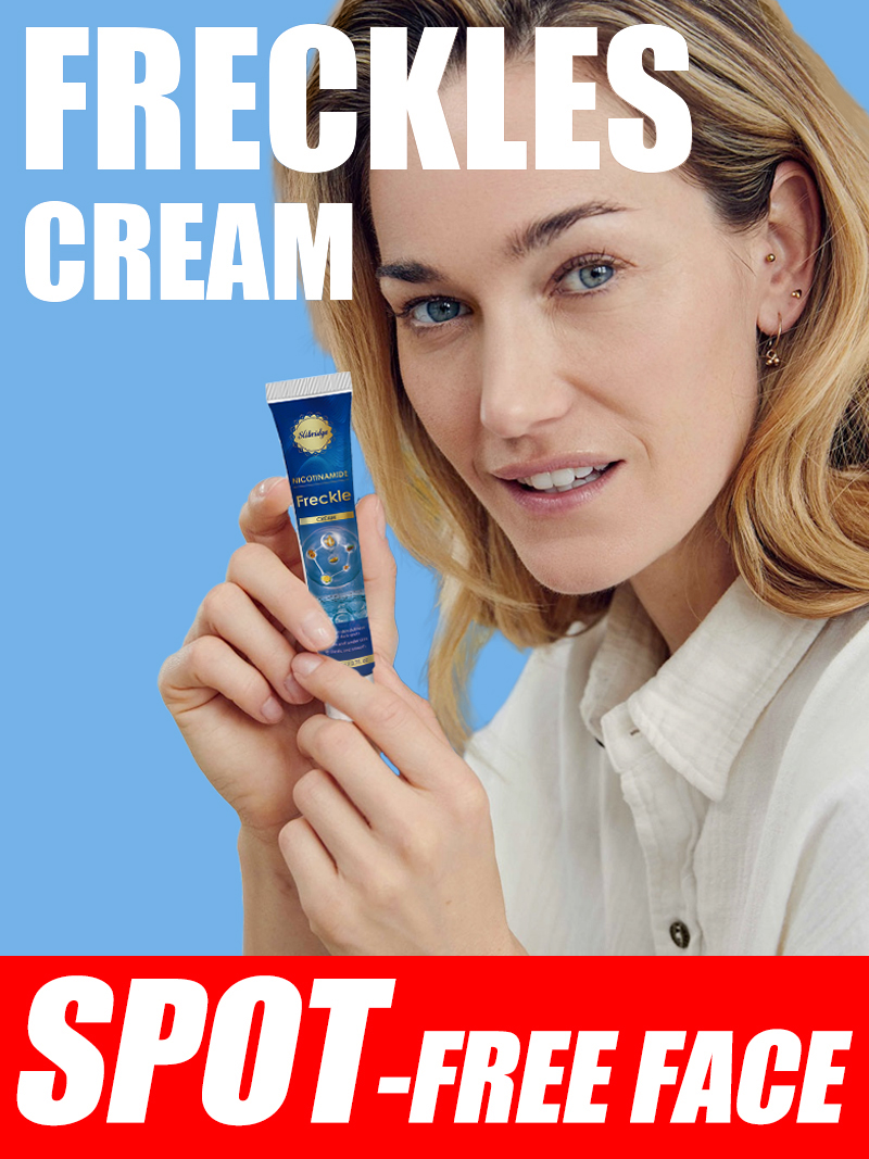 Luxury Skincare Cream - Creme zur Korrektur dunkler Flecken für